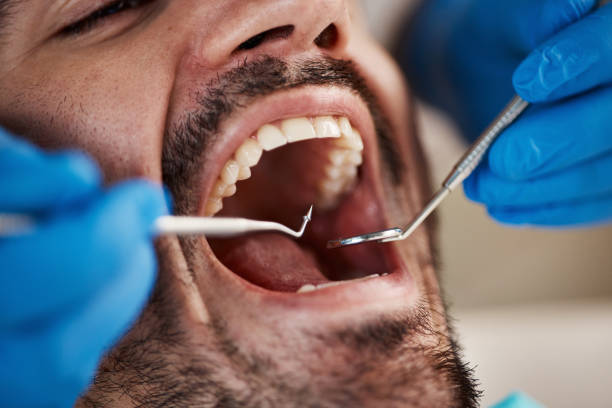 Best Emergency Tooth Extraction  in Whitinsville, MA